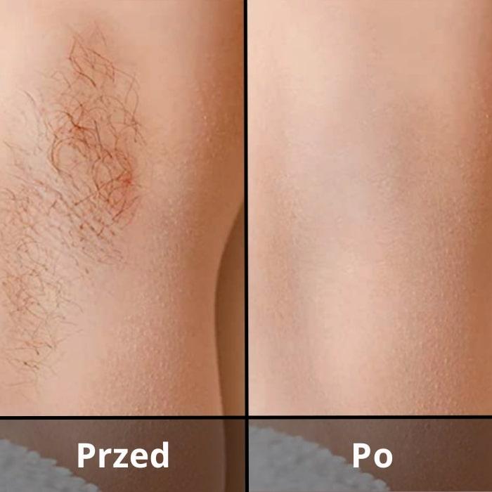 Odylla® Depilator IPL do Twarzy i Ciała